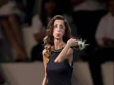 世界最丑女人 怎么吃都不会胖